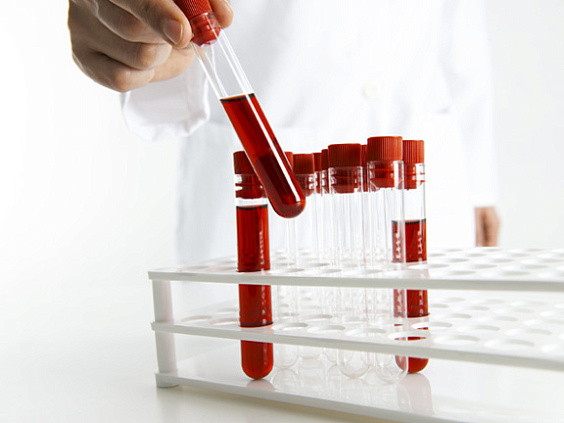 Диета по группе крови: характеристика концепции и влияние на организм