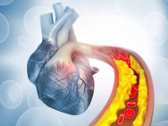 Холестерин