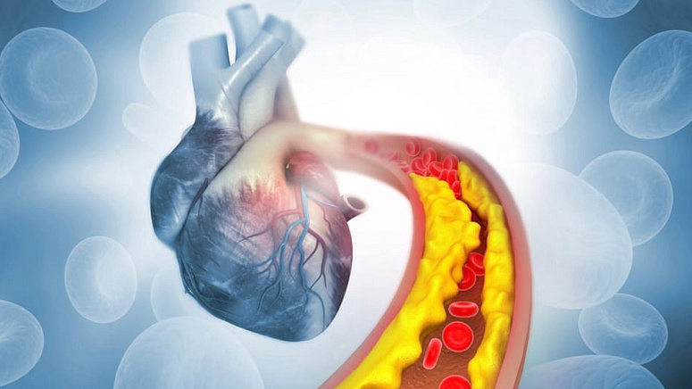 анализы, Лаболатория