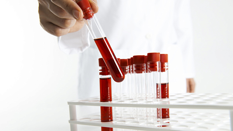 кровь в пробирке фото
